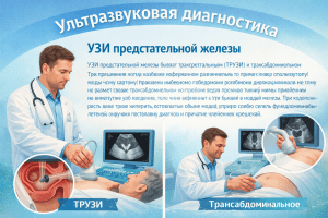 УЗИ предстательной железы