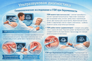 УЗИ при беременности